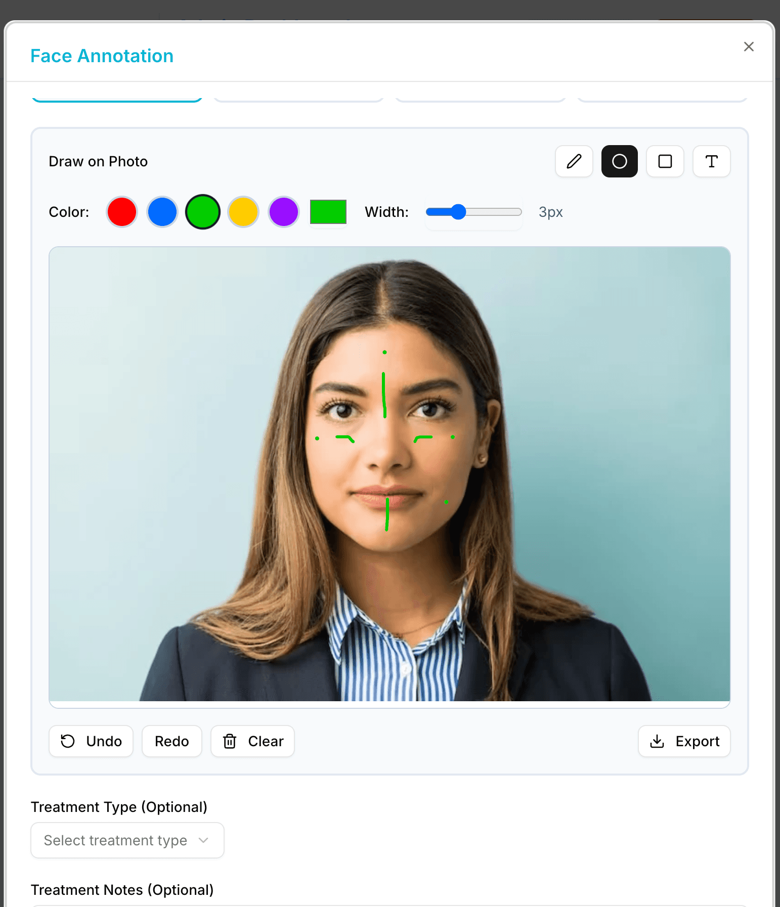 Bookivo face annotations and treatment drawings - Visual treatment planning for aesthetic clinics